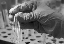 Contagios con hepatitis por transfusión de sangre: el escándalo que afectará a 400.000 personas en Reino Unido