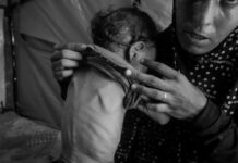 Aumenta la desnutrición en Gaza