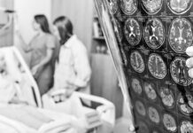 Descubren una combinación de compuestos naturales que limpian el cerebro de ‘proteínas Alzheimer’