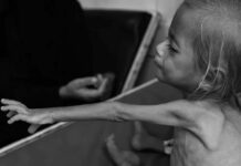 UNICEF alerta que la desnutrición aguda amenaza a 9.300 bebés en Gaza