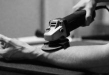 Ucraniano intenta cortarse el brazo para evitar ser enviado al frente