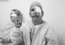 Nicaragua. Recuperan la vista sin pagar un solo centavo